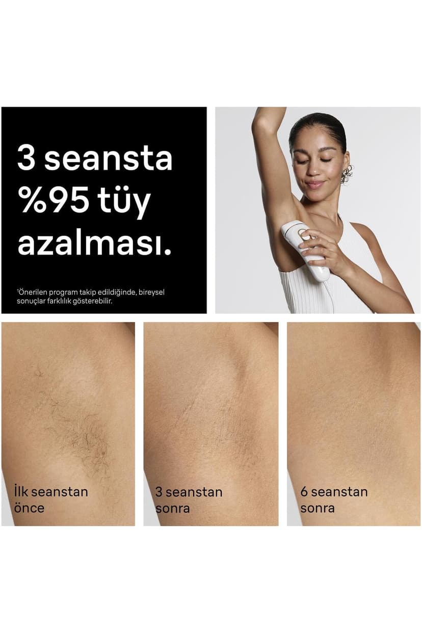 Braun Lumiere Pulsee Smart Silk·Expert Pro 5 Home Laser Alternative, Semi-Definitive Hair Reduction, with Pouch, Gillette Venus Women's Shaver, 3 Heads, PL5311 - 4