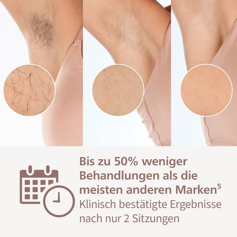 Philips Lumea série 8000 - épilateur à lumière pulsée, alternative à l'épilation laser, technologie SenseIQ, 3 embouts pour le corps, le visage et les zones de précision, BRI946/00 - 4
