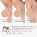 Philips Lumea 8000 Series IPL Hair Removal Device - Alternative to Laser Hair Removal Devices with SenseIQ Technology, 3 Accessories for Body, Face and Precision Zones - BRI946/00 - 3