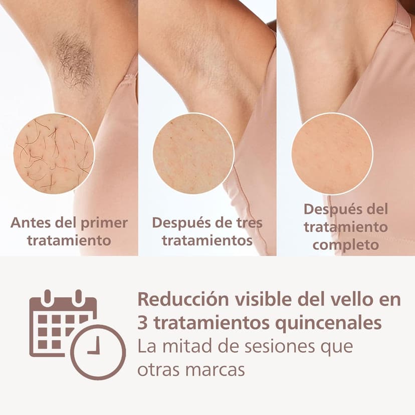 Philips Lumea 8000 Series IPL Hair Removal Device - Alternative to Laser Hair Removal Devices with SenseIQ Technology, 3 Accessories for Body, Face and Precision Zones - BRI946/00 - 3