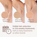 Philips Lumea IPL Hair Removal 8000 Series - Hair Removal Device with SenseIQ Technology, 4 Attachments for Body, Face Bikini and Underarm, Corded Use (Model BRI948/00) - 2