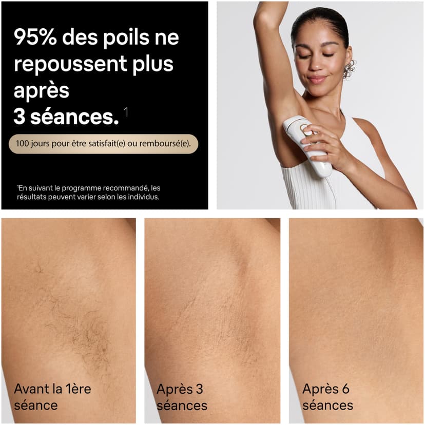 Braun Lumiere Pulsee Smart Silk·Expert Pro 5 Home Laser Alternative, Semi-Definitive Hair Reduction, with Pouch, Gillette Venus Women's Shaver, 3 Heads, PL5311 - 4