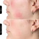 Silk'n Face Mask I LED Face Mask 100 I Face mask skincare with light technology I Reduces fine lines and wrinkles I 4 LED colours - 9