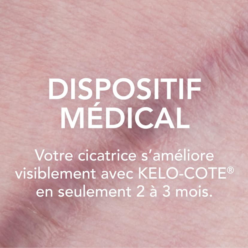 Kelo-cote UV SPF30 Advanced Formula Scar Gel 15g by Kelo-Cote - 3