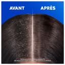 Head & Shoulders Menthol Fresh 2 en 1 Shampoing Antipelliculaire 300ml. Jusqu'à 100% des Pellicules Éliminées, Cliniquement Prouvé. Tous Types de Cheveux. Usage Quotidien. Parfum Frais Menthe  Head & Shoulders Menthol Fresh 2 en 1 Shampoing Antipelliculaire 300ml. Jusqu'à 100% des Pellicules Éliminées, Cliniquement Prouvé. Tous Types de Cheveux. Usage Quotidien. Parfum Frais Menthe - 5