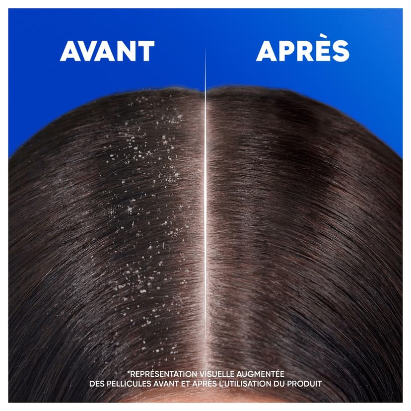 Head & Shoulders Menthol Fresh 2 en 1 Shampoing Antipelliculaire 300ml. Jusqu'à 100% des Pellicules Éliminées, Cliniquement Prouvé. Tous Types de Cheveux. Usage Quotidien. Parfum Frais Menthe  Head & Shoulders Menthol Fresh 2 en 1 Shampoing Antipelliculaire 300ml. Jusqu'à 100% des Pellicules Éliminées, Cliniquement Prouvé. Tous Types de Cheveux. Usage Quotidien. Parfum Frais Menthe - 5