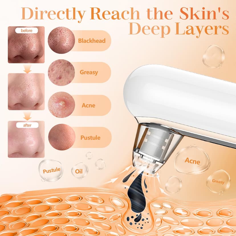 Yccu Aspirateur Point Noir Extracteur Points Noirs Visage Tire Comedon Points Noirs Anti Point Noir Nez Nettoyage des Pore Peau Soin Visage Blackhead Removal 4 Sondes et 4 Modes Rechargeable - 3