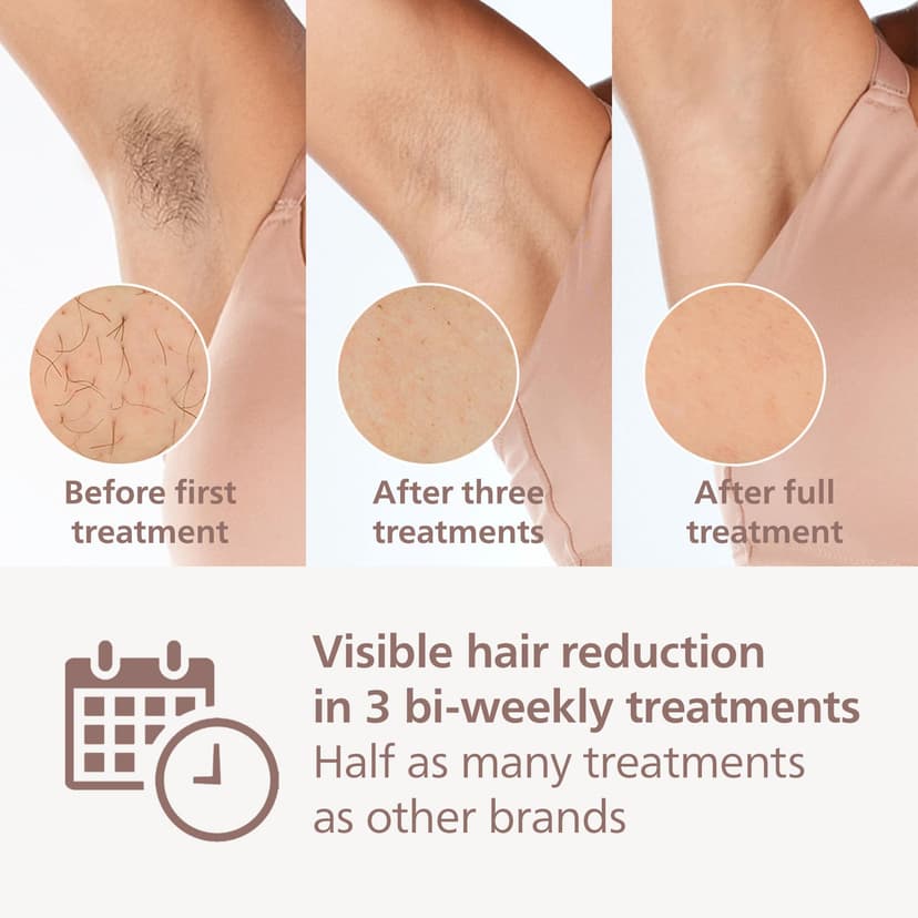 Philips Lumea IPL Hair Removal 8000 Series - Hair Removal Device with SenseIQ Technology, 4 Attachments for Body, Face Bikini and Underarm, Corded Use (Model BRI948/00) - 2