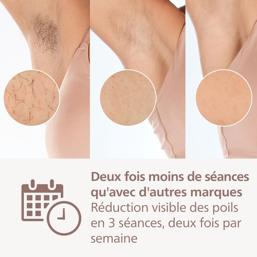 Philips Lumea série 9900 - épilateur à lumière pulsée, alternative à l'épilation laser, SenseIQ et SkinAI, 2 embouts pour le corps et le visage, BRI950/02 - 4